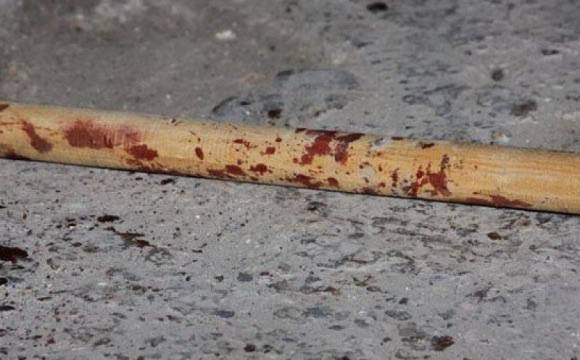 У Дніпрі 45-річному чоловіку повідомили про підозру за жорстоке побиття 49-річн…