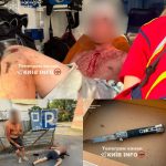 ЖАХ! 19-річний студент порізав ножем трьох людей, один постраждалий у комі, — пр…